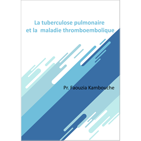 La tuberculose pulmonaire et la  maladie thromboembolique  - FAOUZIA KAMBOUCHE
